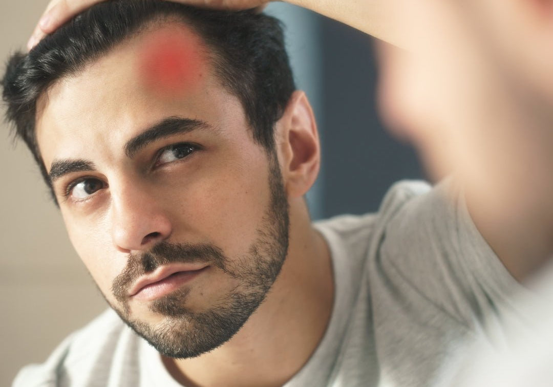 Can Stress Cause Inflammation? The Connection Between Stress and Your Body's Immune Response - TMGskin.com