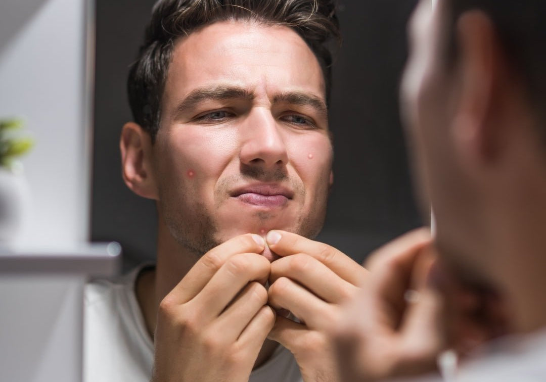 Can Anxiety Cause Pimples? The Connection Between Stress and Breakouts - TMGskin.com