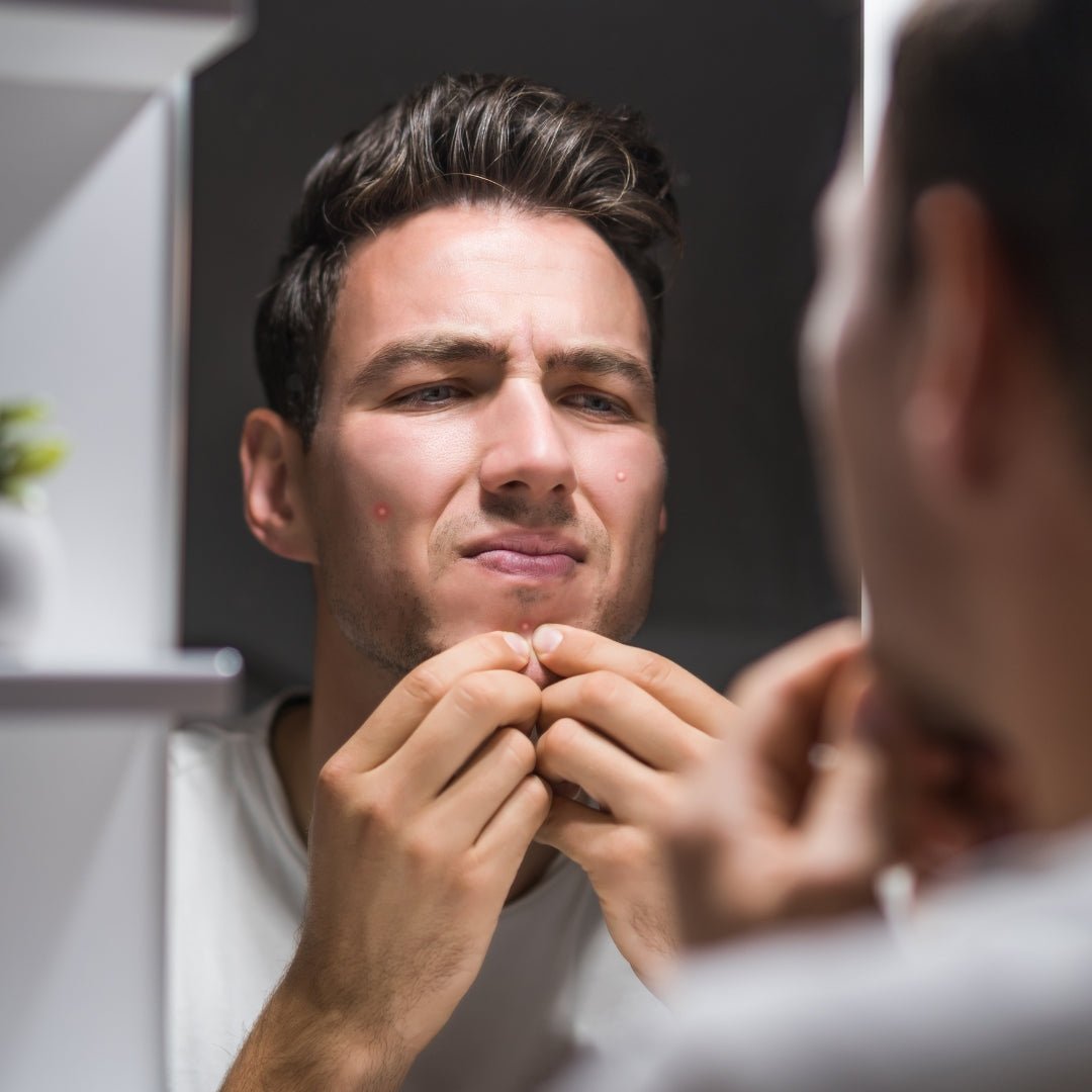 Can Anxiety Cause Pimples? The Connection Between Stress and Breakouts - TMGskin.com