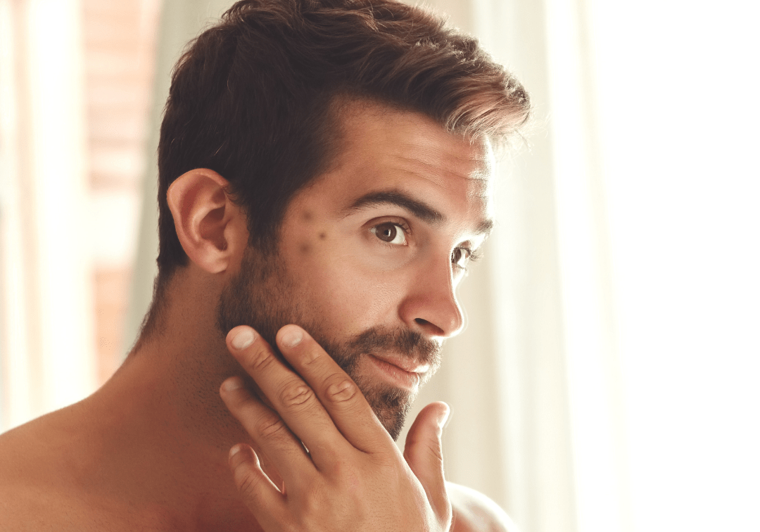 How to Clear Dark Spots: Achieving a Smooth, Even Complexion - TMGskin.com