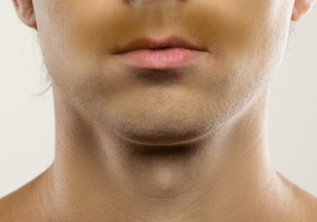 Melanated Skin: Understanding and Caring for Richly Pigmented Skin - TMGskin.com