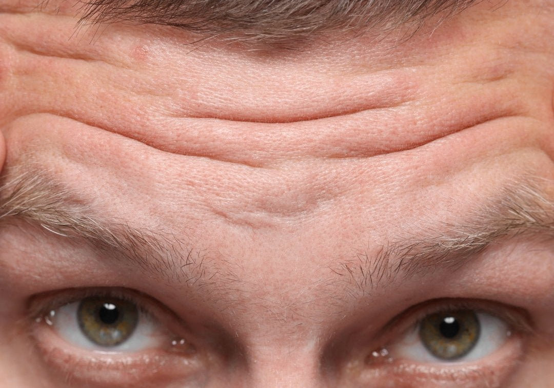 Prevent Premature Aging in Men - TMGskin.com