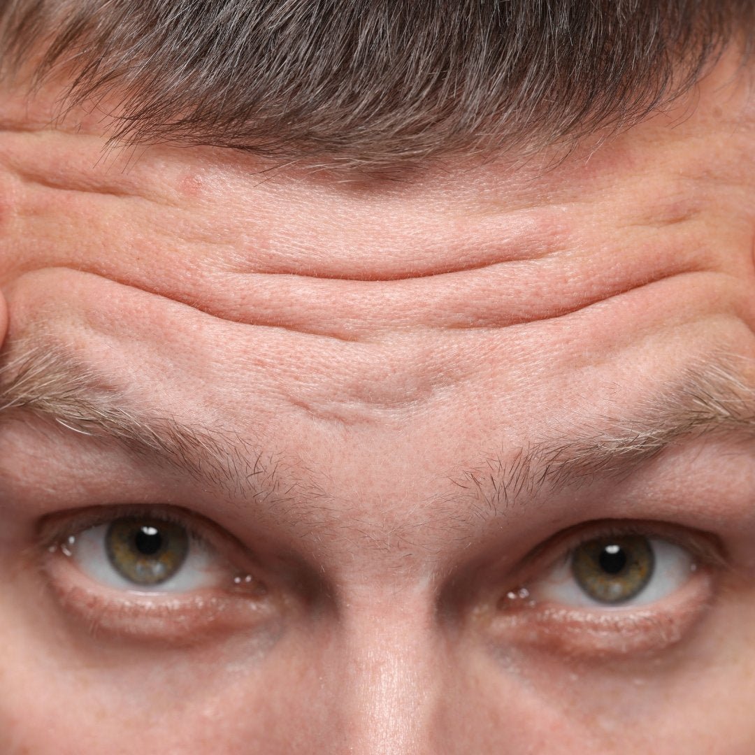 Prevent Premature Aging in Men - TMGskin.com