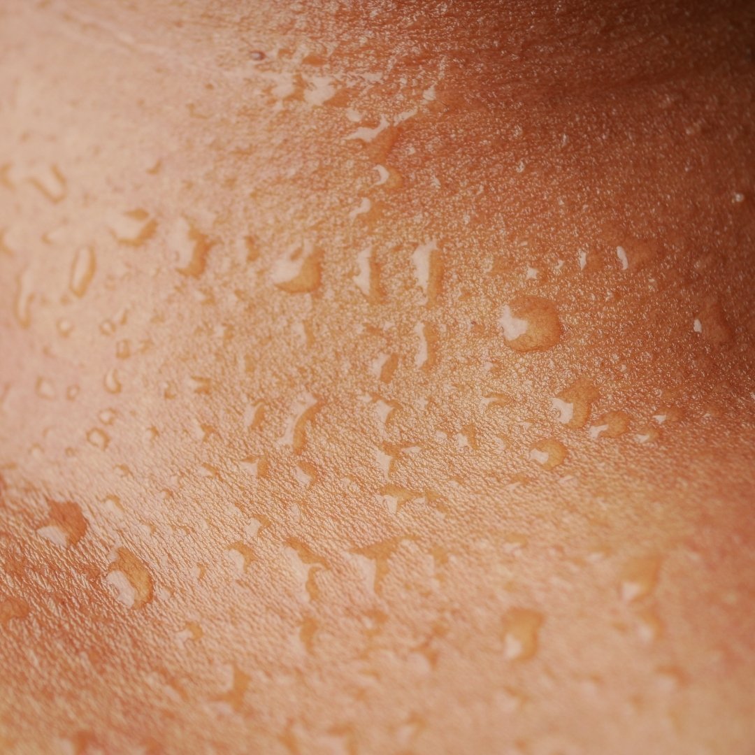 The Basics of Skin Hydration - TMGskin.com