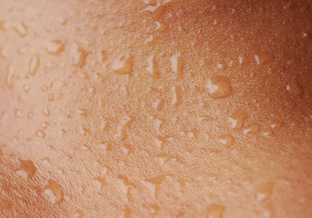 The Basics of Skin Hydration - TMGskin.com