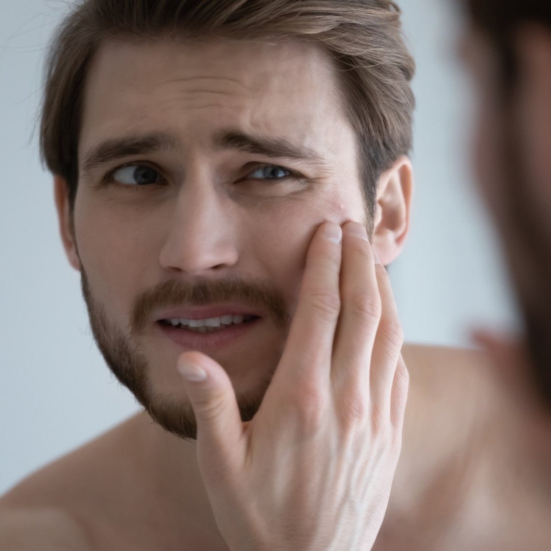 Why Your Skin Breaks Out Suddenly - TMGskin.com